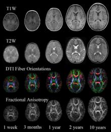 Sample MRI and DTI images from the study